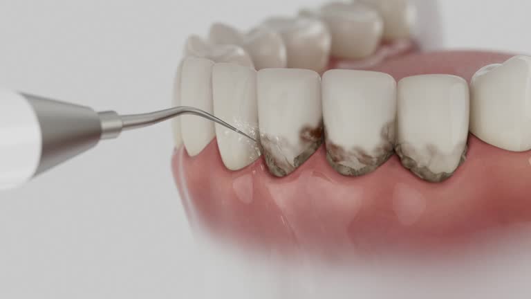 Reliable Teeth Cleaning And Checkup contractor in Boron, CA by Smile Center Dentistry